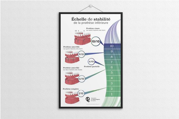 Affiche laminée échelle de stabilité (11 X 17)